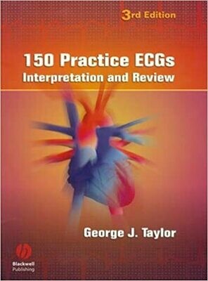 150 Practice ECGs: Interpretation and Review 3rd Edition