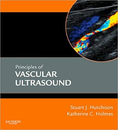 Principles of Vascular Ultrasound 1st Edition