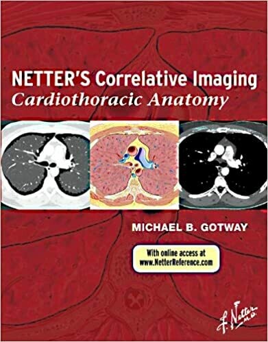 Netter&#39;s Correlative Imaging: Cardiothoracic Anatomy 1st Edition