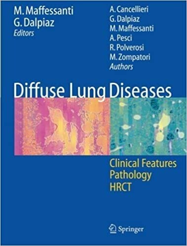 Diffuse Lung Diseases: Clinical Features, Pathology, HRCT 1st Edition