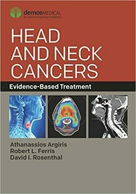 Head and Neck Cancers: Evidence-Based Treatment 1st Edition