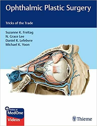 Ophthalmic Plastic Surgery: Tricks of the Trade 1st Edition
