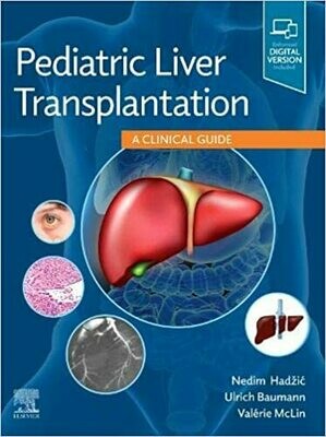 Pediatric Liver Transplantation: A Clinical Guide 1st Edition