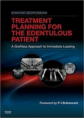 Implant Treatment Planning for the Edentulous Patient: A Graftless Approach to Immediate Loading 1st Edition