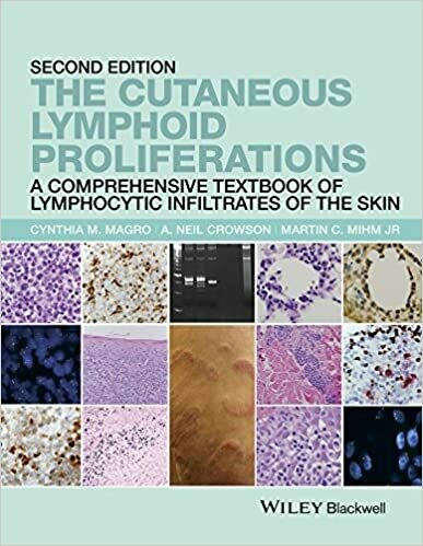 The Cutaneous Lymphoid Proliferations: A Comprehensive Textbook of Lymphocytic Infiltrates of the Skin 2nd Edition