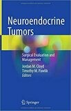 Neuroendocrine Tumors: Surgical Evaluation and Management 1st Edition