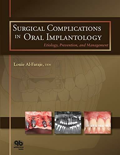 Surgical Complications in Oral Implantology: Etiology, Prevention, and Management