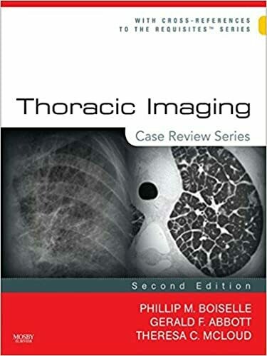 Thoracic Imaging: Case Review Series 2nd Edition