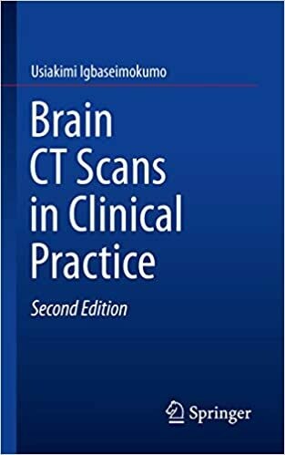 Brain CT Scans in Clinical Practice 2nd Edition