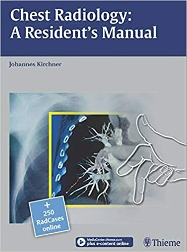 Chest Radiology: A Resident&#39;s Manual 1st Edition