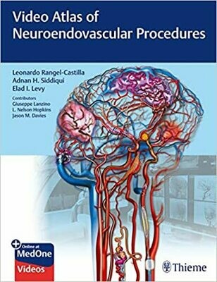 Video Atlas of Neuroendovascular Procedures 1st Edition