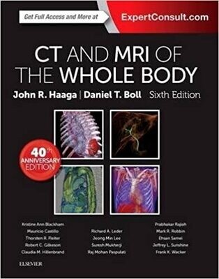 CT and MRI of the Whole Body