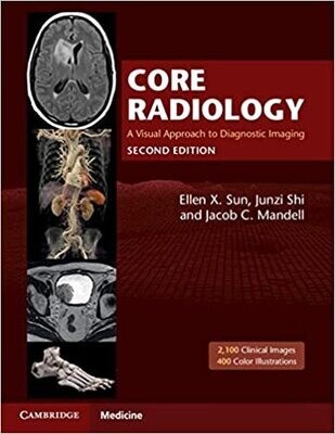 Core Radiology 2nd Edition 2021