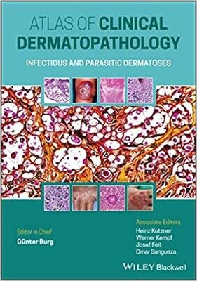 Atlas of Clinical Dermatopathology: Infectious and Parasitic Dermatoses 1st Edition