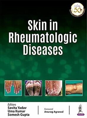 Skin In Rheumatologic Diseases
