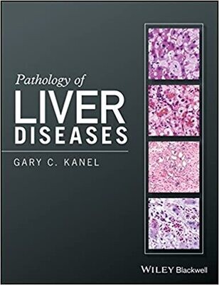 Pathology of Liver Diseases 1st Edition