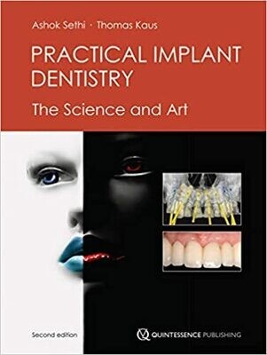 Practical Implant Dentistry: The Science and Art 2nd Edition