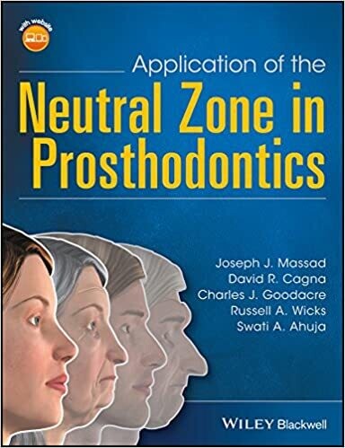 Application of the Neutral Zone in Prosthodontics 1st Edition