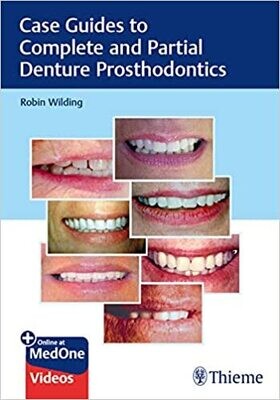 Case Guides to Complete and Partial Denture Prosthodontics 1st Edition