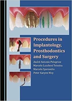 Procedures in Implantology, Prosthodontics and Surgery 1st Edition