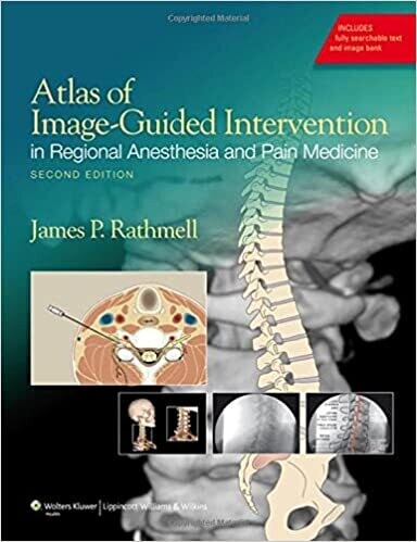 Atlas of Image-Guided Intervention in Regional Anesthesia and Pain Medicine Second Edition