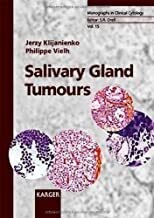 Salivary Gland Tumours (Monographs in Clinical Cytology, Vol. 15) 1st Edition