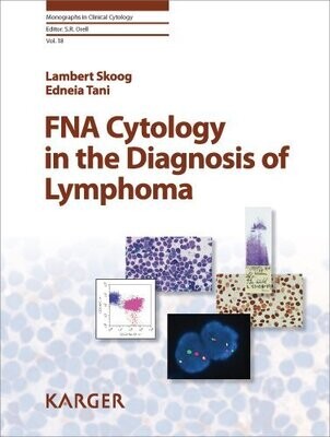 FNA Cytology in the Diagnosis of Lymphoma: In collaboration with A. Porwit (Stockholm) (Monographs in Clinical Cytology, Vol. 18)