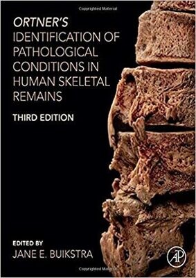 Ortner&#39;s Identification of Pathological Conditions in Human Skeletal Remains 3rd Edition