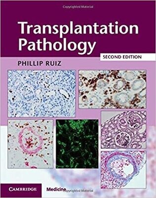 Transplantation Pathology Hardback with Online Resource 2nd Edition