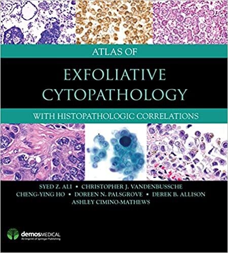 Atlas of Exfoliative Cytopathology: With Histopathologic Correlations 1st Edition