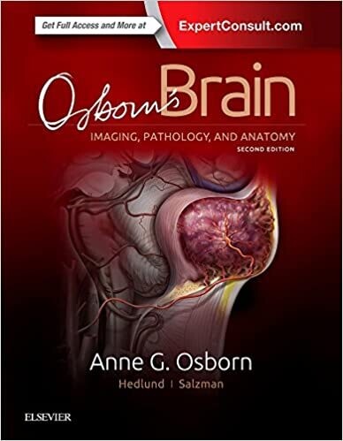 Osborn&#39;s Brain 2nd Edition