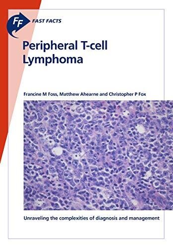 Fast Facts: Peripheral T-cell Lymphoma: Unraveling the complexities of diagnosis and management