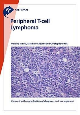 Fast Facts: Peripheral T-cell Lymphoma: Unraveling the complexities of diagnosis and management