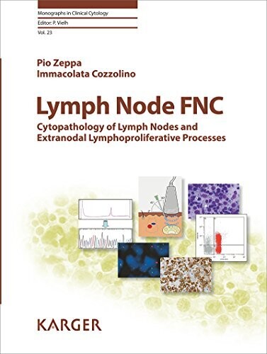 Lymph Node FNC: Cytopathology of Lymph Nodes and Extranodal Lymphoproliferative Processes