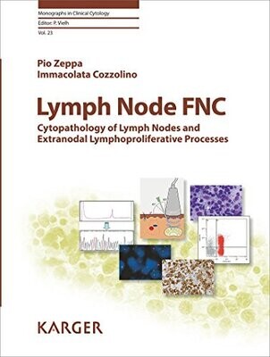 Lymph Node FNC: Cytopathology of Lymph Nodes and Extranodal Lymphoproliferative Processes