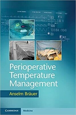 Perioperative Temperature Management 1st Edition