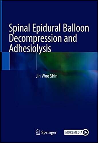 Spinal Epidural Balloon Decompression and Adhesiolysis 1st ed. 2021 Edition
