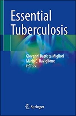Essential Tuberculosis 1st ed. 2021 Edition