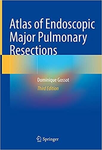 Atlas of Endoscopic Major Pulmonary Resections 3rd Edition