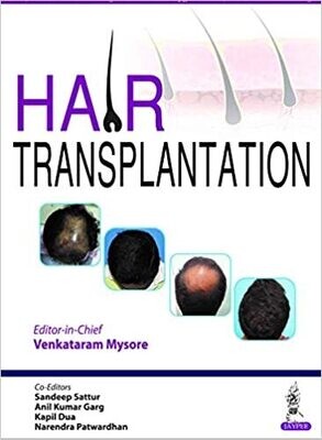Hair Transplantation 1st Edition
