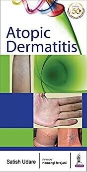 Atopic Dermatitis