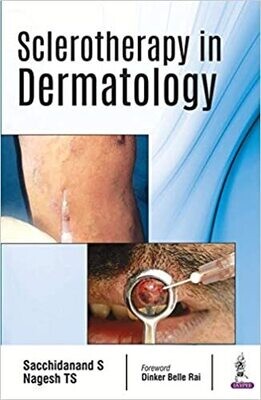 Sclerotherapy in Dermatology 1st Edition