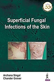 Superficial Fungal Infections of the Skin
