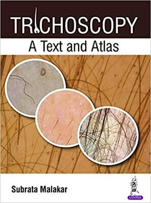 Trichoscopy: A Text and Atlas 1st Edition