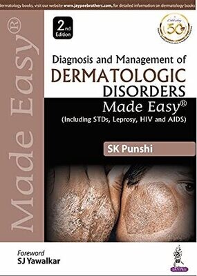 Diagnosis and Management of Dermatologic Disorders Made Easy (including STDs, Leprosy, HIV and AIDS)