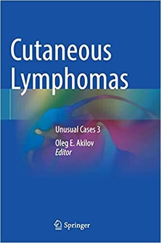 Cutaneous Lymphomas: Unusual Cases 3 1st ed. 2021 Edition