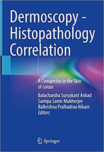 Dermoscopy - Histopathology Correlation: A Conspectus in the Skin of colour 1st ed. 2021 Edition