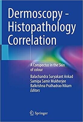 Dermoscopy - Histopathology Correlation: A Conspectus in the Skin of colour 1st ed. 2021 Edition