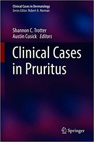 Clinical Cases in Pruritus (Clinical Cases in Dermatology) 1st ed. 2021 Edition