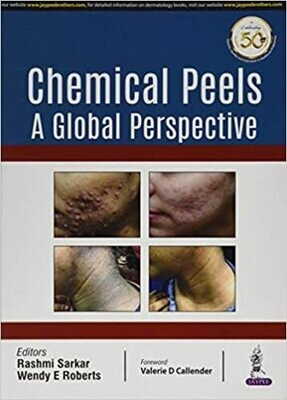 Chemical Peels: A Global Perspective 1st Edition